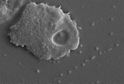  Acanthamoeba: A Microscopic Marvel With Tentacle-Like Pseudopods and Voracious Appetite!