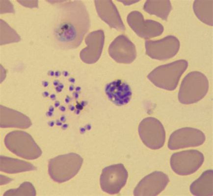 Falciparum! Discover This Tiny Terror Lurking Within Your Red Blood Cells