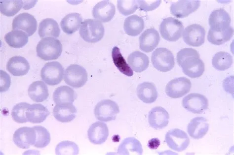 Falciparum Malaria Parasite: A Tiny Terror That Wreaks Havoc On Human Health With Its Relentless Cycle Of Infection!