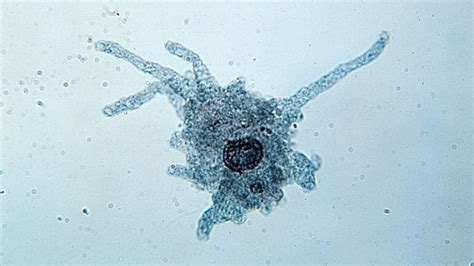 Investigating Interesting Iodamoeba: This Microscopic Amoeba Thrives on Decaying Organic Matter and Exhibits Remarkable Adaptability